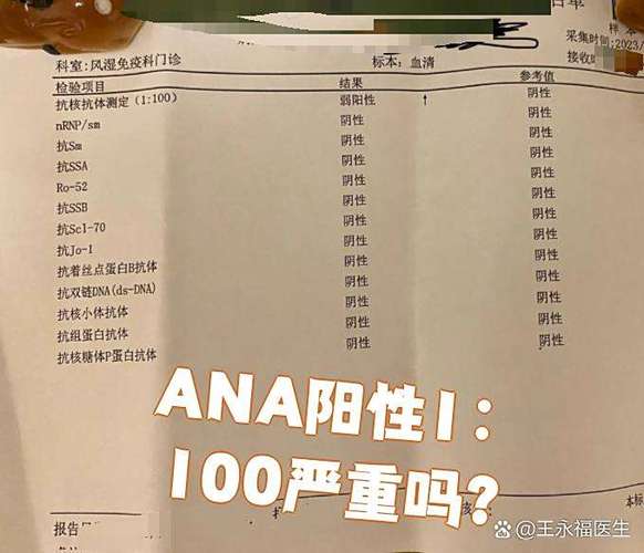 ana阴性好还是阳性好