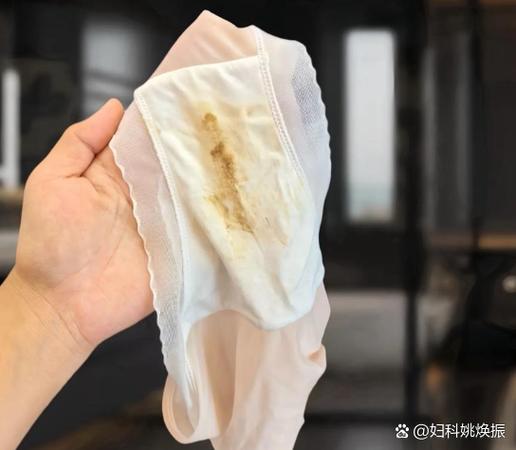 白带发黄粘稠是什么原因
