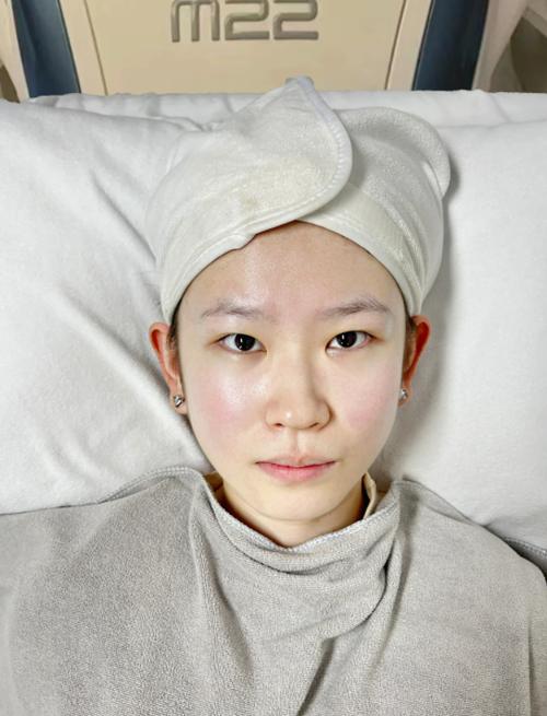 脸部美容多久做一次合适