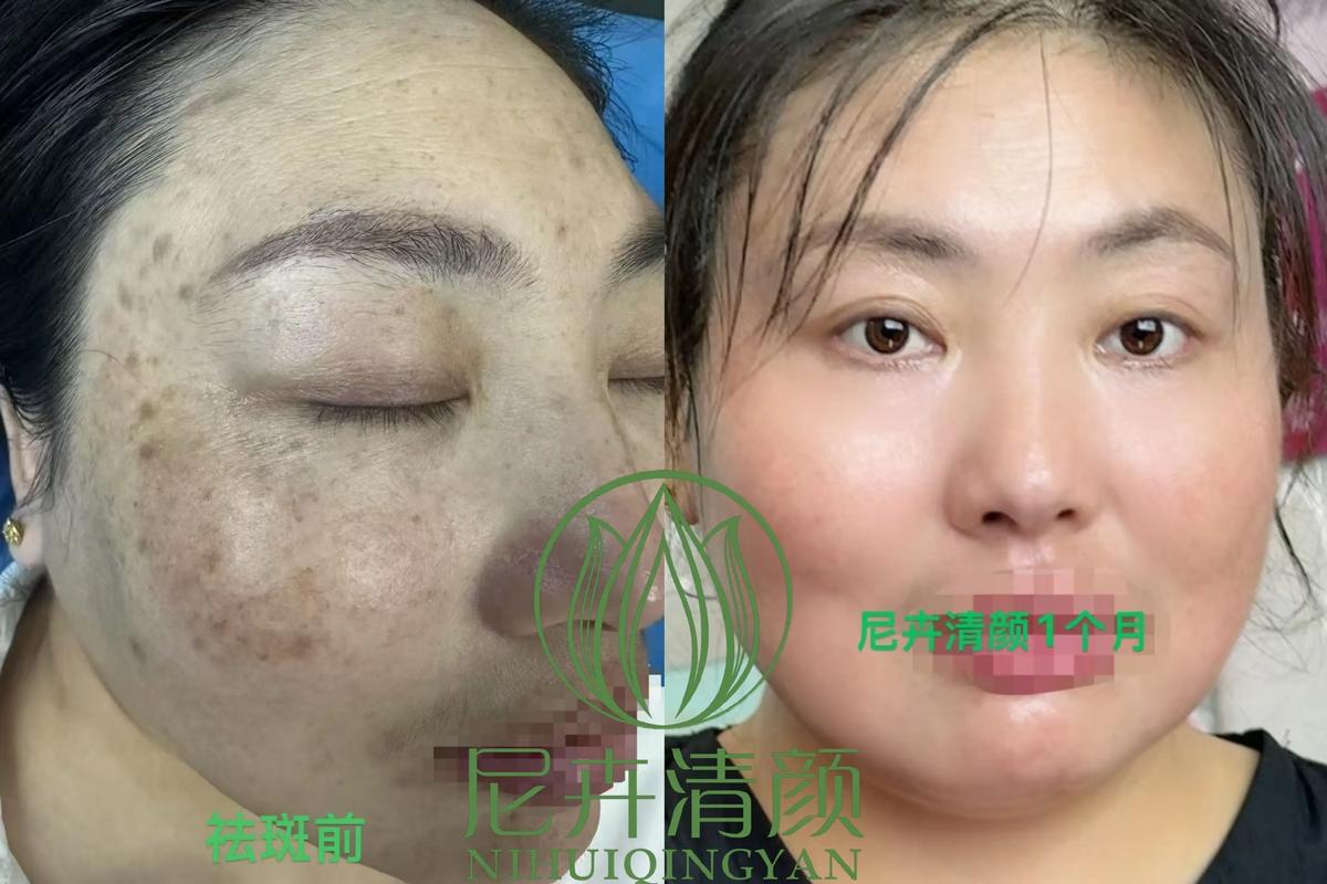 手机屏幕上有白色亮斑怎么回事