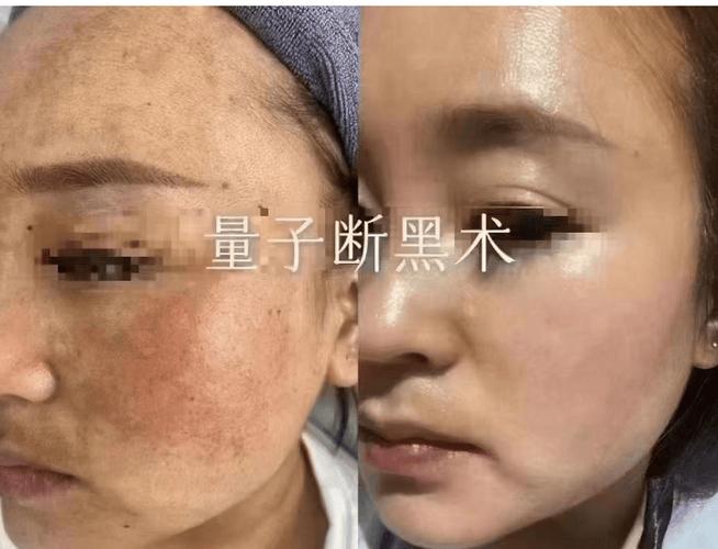 屏幕出现黑斑但触摸正常