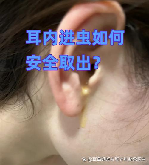 耳朵里有虫子进去了怎么弄出来