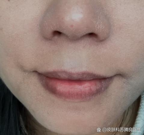 美容做面部护理几天去一次