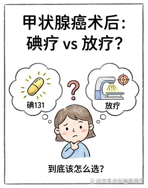 淋巴转移几个需做碘131
