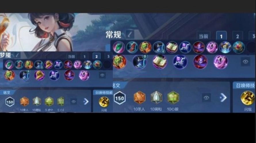 辅助怎么出装 辅助怎么出装