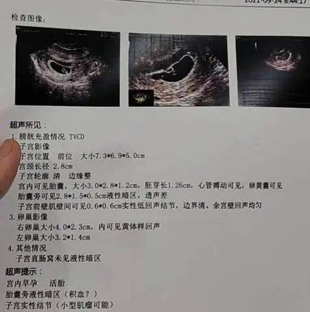 小暗区多久变成孕囊