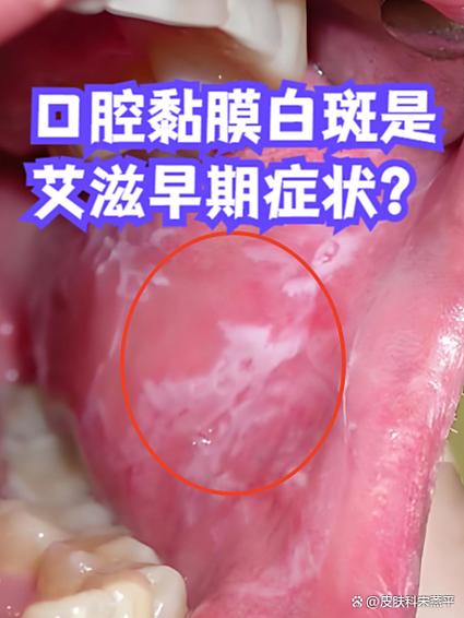 手机屏幕白色背景下有白色亮斑