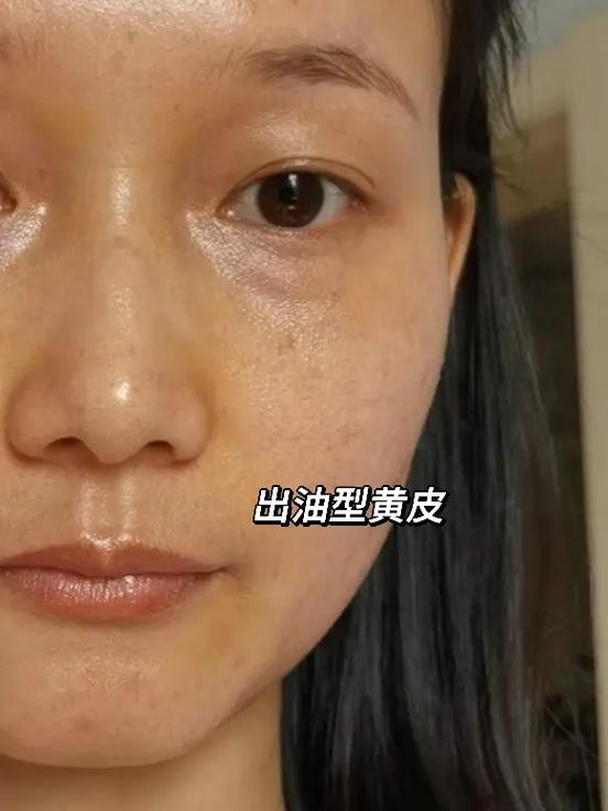 脸色突然发黄是什么原因