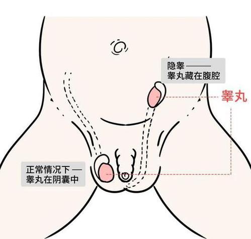 睾丸外皮痒是什么原因