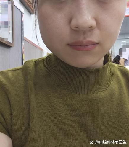 经常吃饭的一边脸是大是小