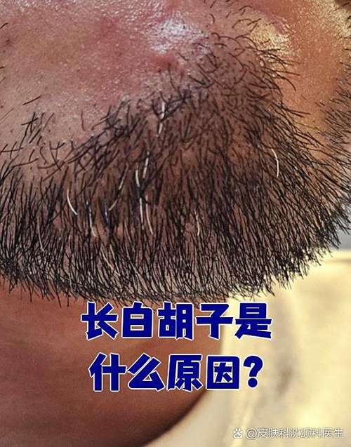 为什么会长白色胡子